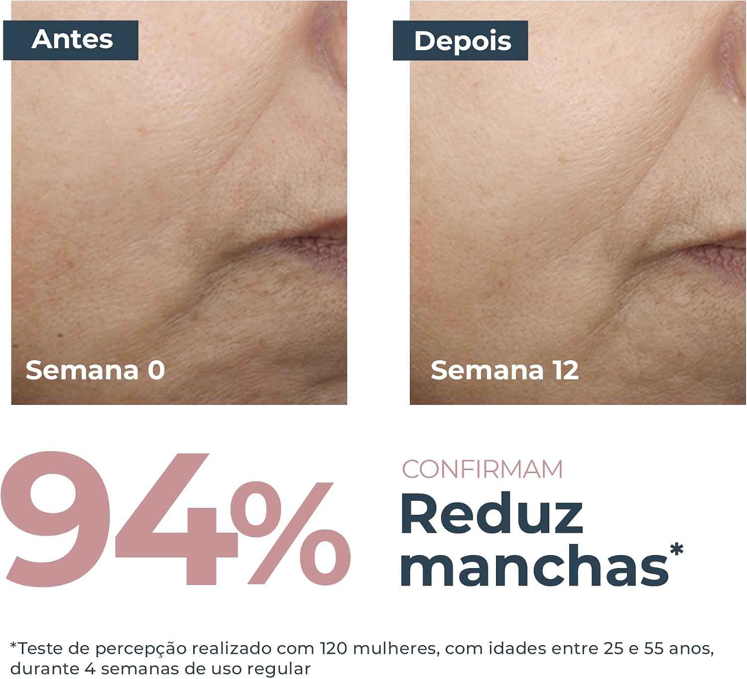 Evidencia o ativo Thiamidol e o posicionamento do creme como tratamento para manchas e hiperpigmentação.